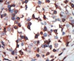 PKC beta Antibody in Immunohistochemistry (IHC)