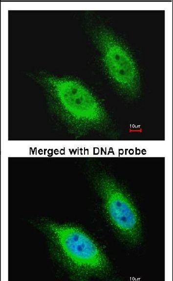 PKC epsilon Antibody in Immunocytochemistry (ICC/IF)