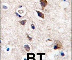PKC gamma Antibody in Immunohistochemistry (IHC)