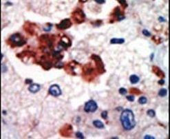 PKC lambda/iota Antibody in Immunohistochemistry (IHC)