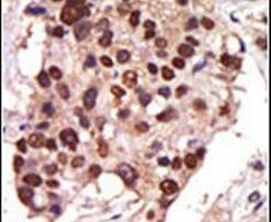 PRKD3 Antibody in Immunohistochemistry (IHC)
