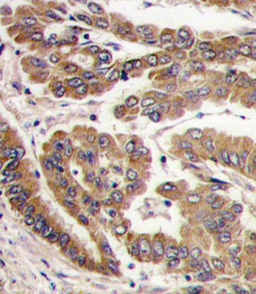 PKC zeta Antibody in Immunohistochemistry (IHC)
