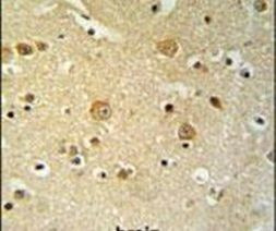PLEKHH2 Antibody in Immunohistochemistry (IHC)