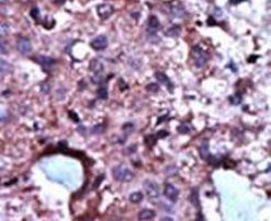 PKLR Antibody in Immunohistochemistry (IHC)