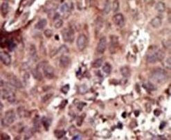 PKLR Antibody in Immunohistochemistry (IHC)