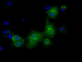 PKLR Antibody in Immunocytochemistry (ICC/IF)