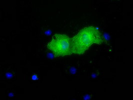PKLR Antibody in Immunocytochemistry (ICC/IF)