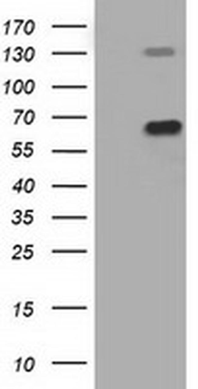 PKLR Antibody in Western Blot (WB)