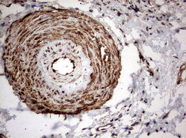 PKM1 Antibody in Immunohistochemistry (Paraffin) (IHC (P))
