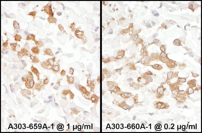 PKM2 Antibody in Immunohistochemistry (IHC)