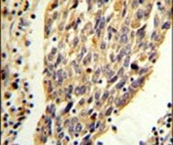 PKM2 Antibody in Immunohistochemistry (IHC)