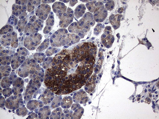 PKM2 Antibody in Immunohistochemistry (Paraffin) (IHC (P))