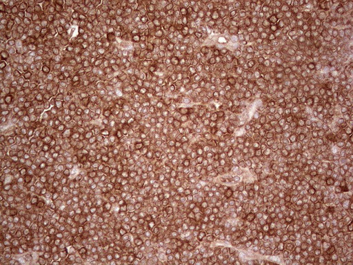 PKM2 Antibody in Immunohistochemistry (Paraffin) (IHC (P))