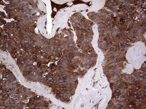 PKM2 Antibody in Immunohistochemistry (Paraffin) (IHC (P))