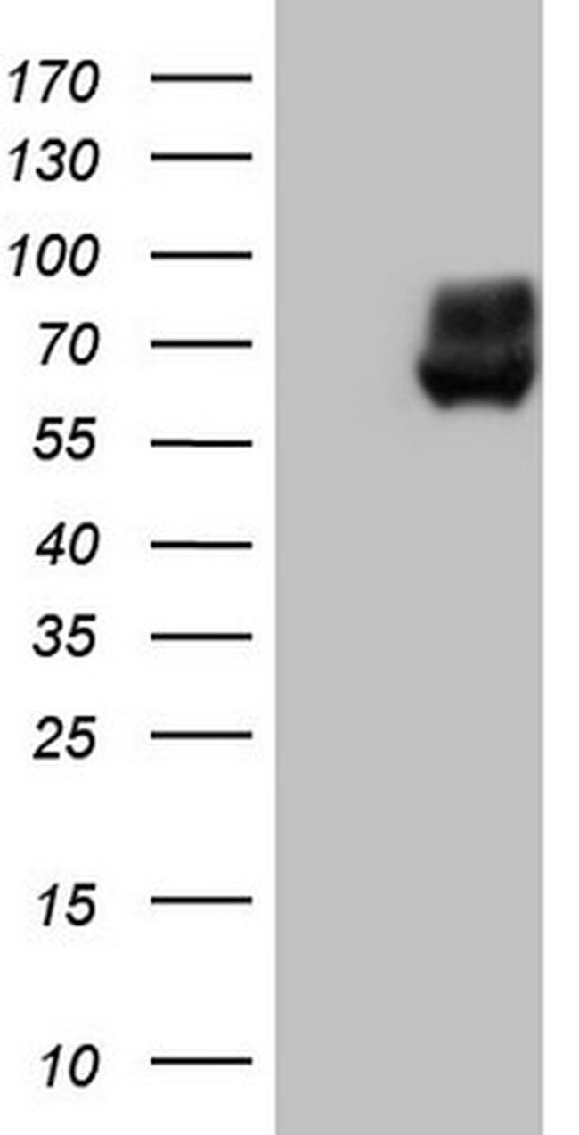 PKM2 Antibody in Western Blot (WB)