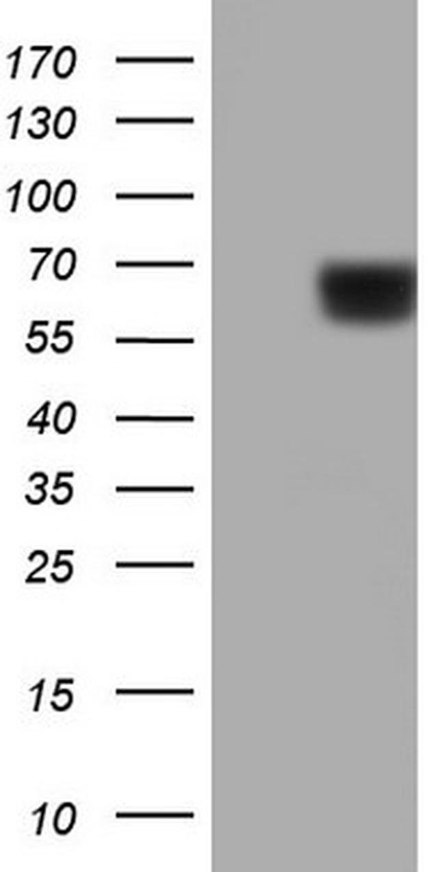 PKM2 Antibody in Western Blot (WB)