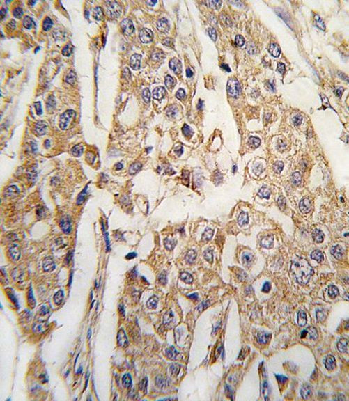 PKM2 Antibody in Immunohistochemistry (IHC)
