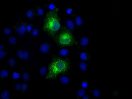 PKMYT1 Antibody in Immunocytochemistry (ICC/IF)