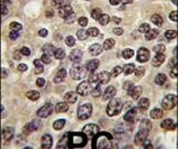 PKN3 Antibody in Immunohistochemistry (IHC)