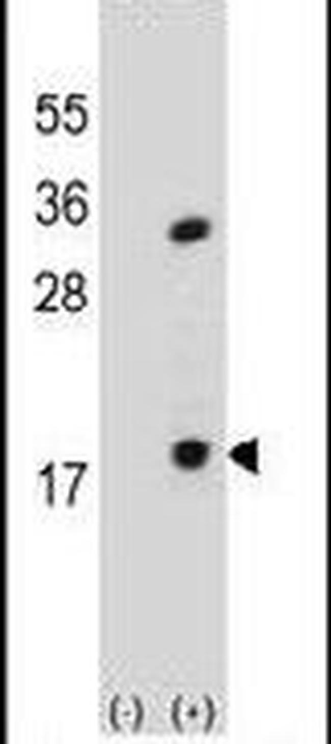 PLA2 Antibody in Western Blot (WB)