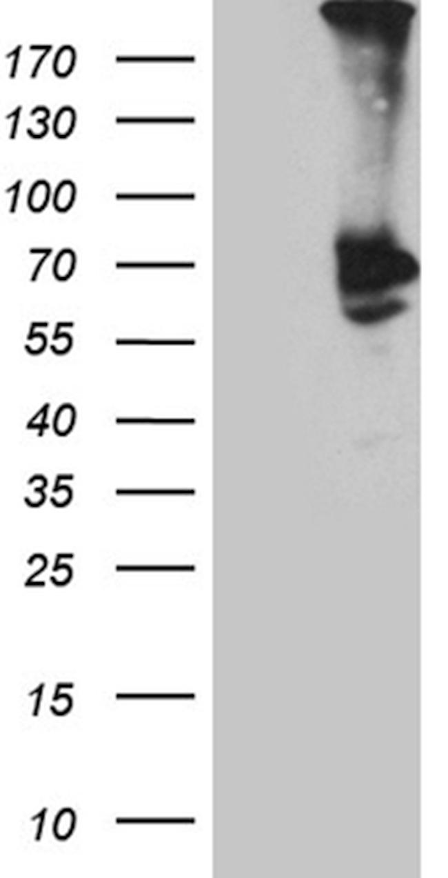PLA2G3 Antibody in Western Blot (WB)