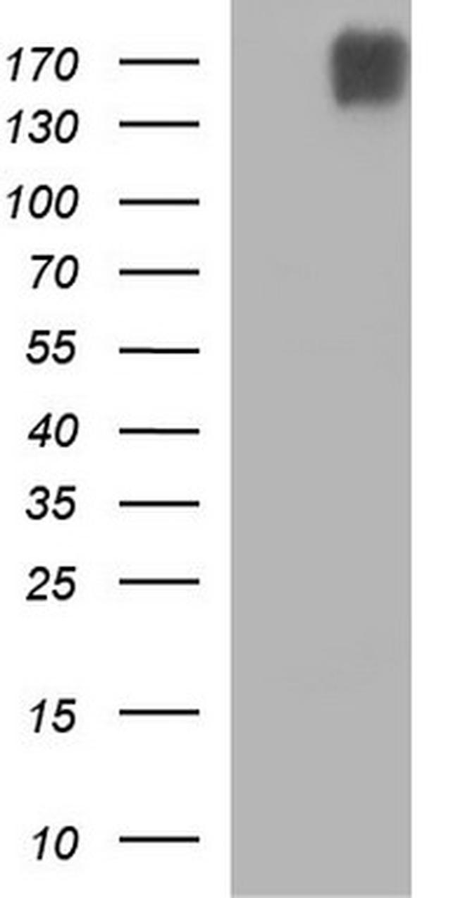 PLB1 Antibody in Western Blot (WB)