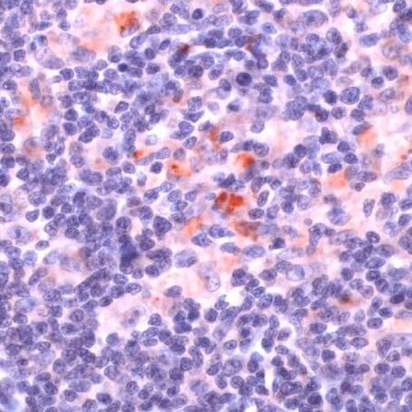 PLCG2 Antibody in Immunohistochemistry (IHC)