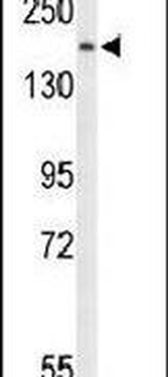 PLCB1 Antibody in Western Blot (WB)