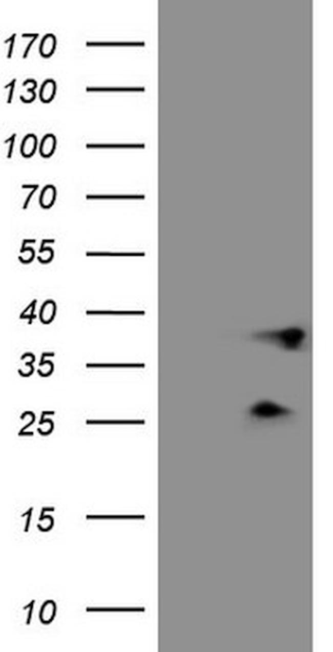 PLCXD1 Antibody in Western Blot (WB)