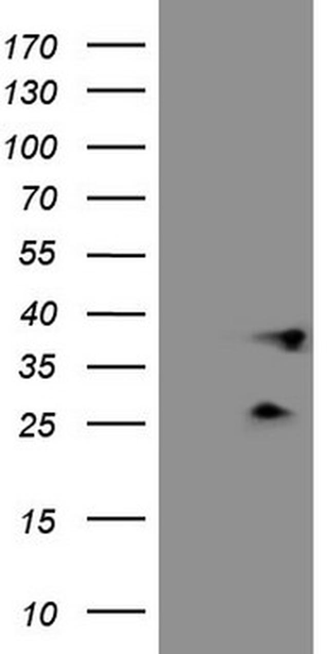 PLCXD1 Antibody in Western Blot (WB)