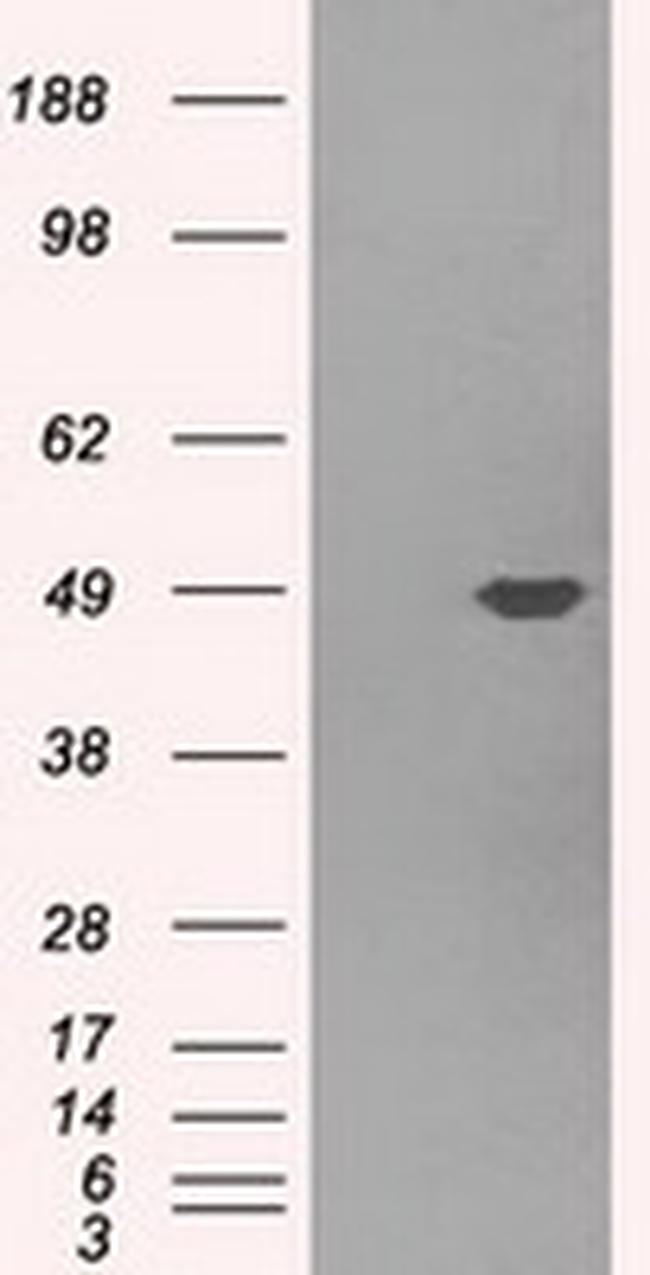 PLEK Antibody in Western Blot (WB)