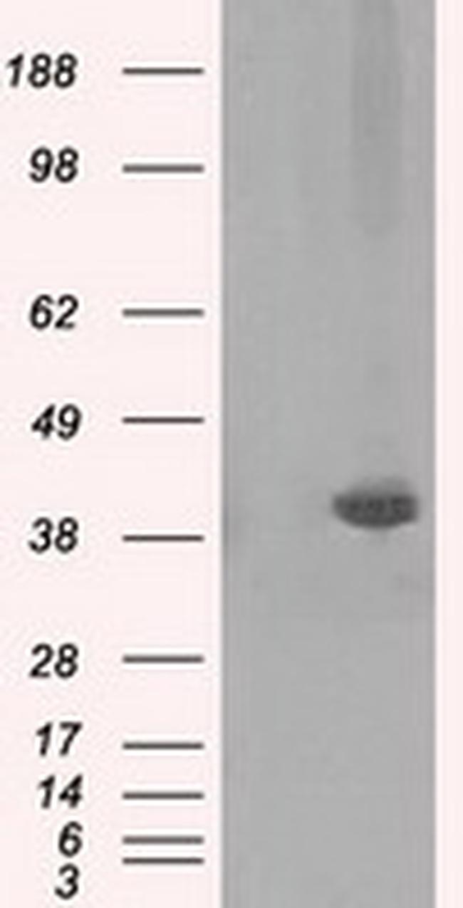 PLEK Antibody in Western Blot (WB)