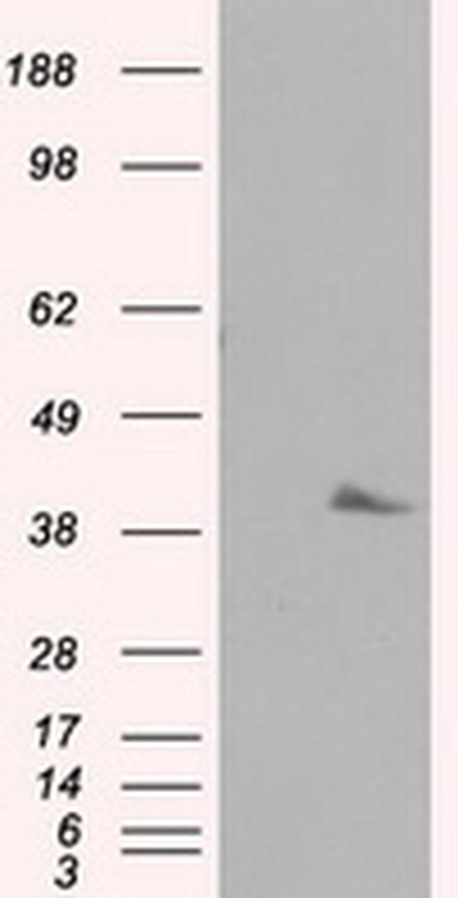 PLEK Antibody in Western Blot (WB)