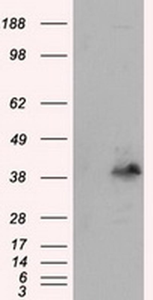 PLEK Antibody in Western Blot (WB)