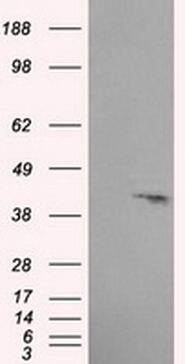 PLEK Antibody in Western Blot (WB)