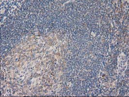 PLEKHA3 Antibody in Immunohistochemistry (Paraffin) (IHC (P))