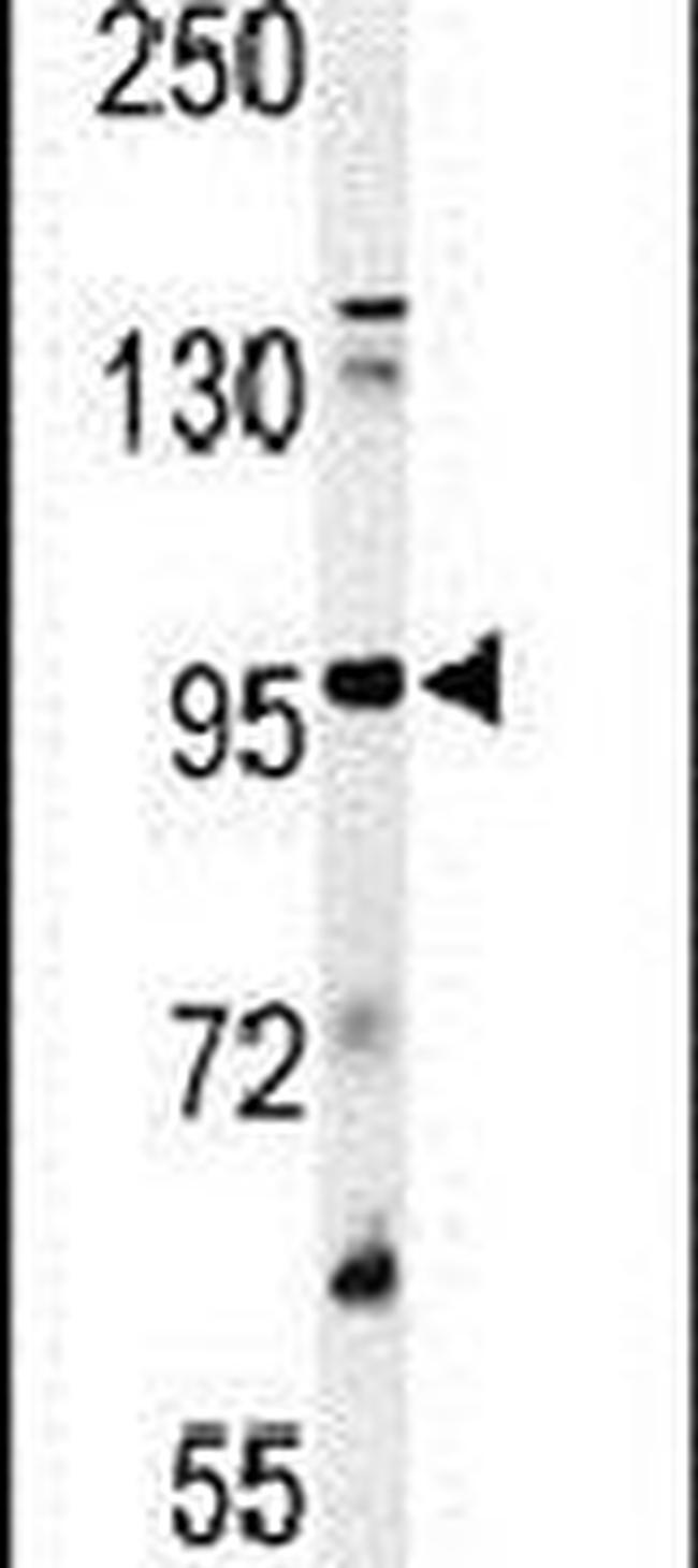 Plasminogen Antibody in Western Blot (WB)