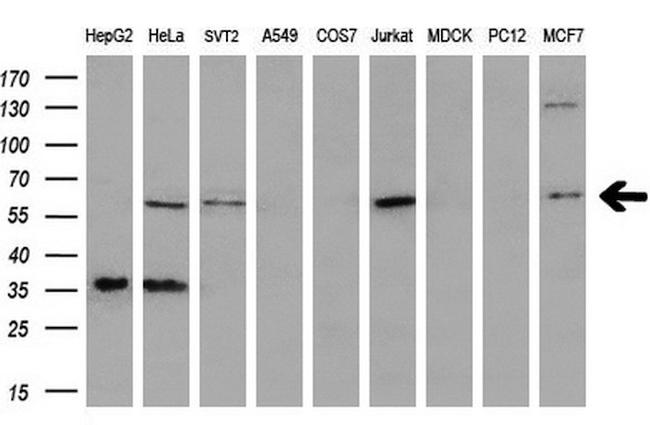 PLK1 Antibody in Western Blot (WB)