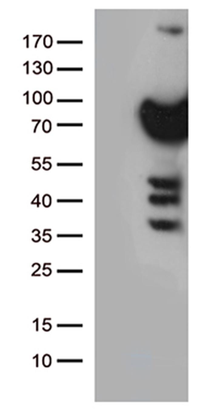 PLK1 Antibody in Western Blot (WB)