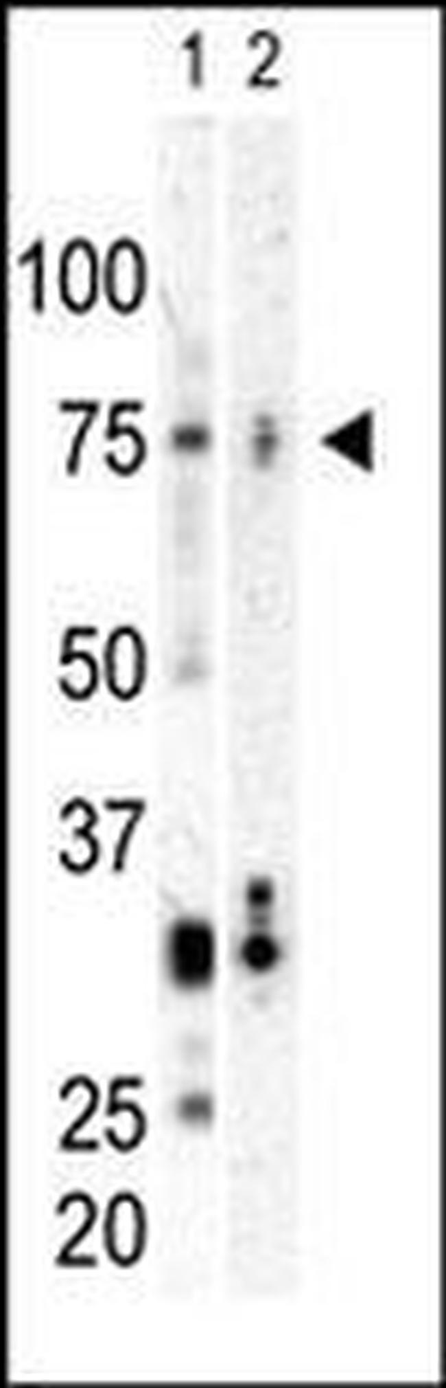 PLK3 Antibody in Western Blot (WB)