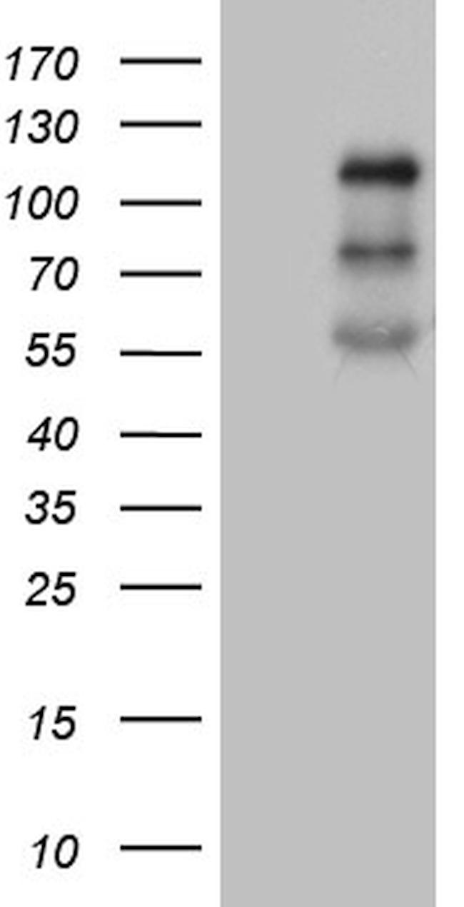 PLK4 Antibody in Western Blot (WB)