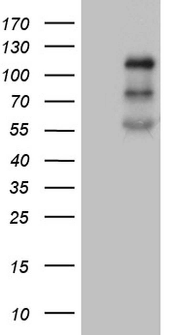 PLK4 Antibody in Western Blot (WB)