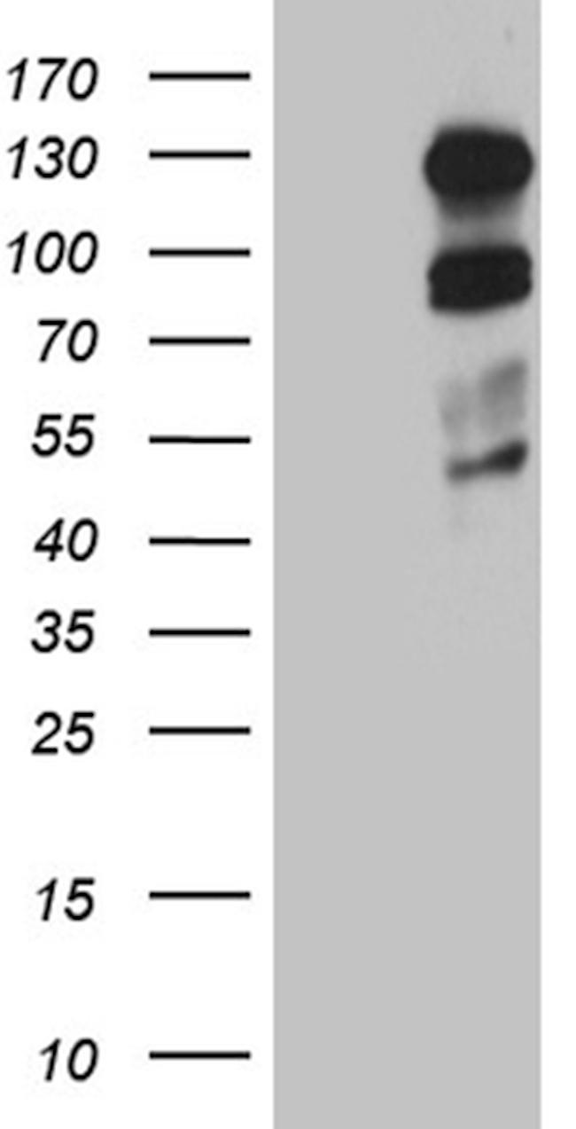 PLK4 Antibody in Western Blot (WB)