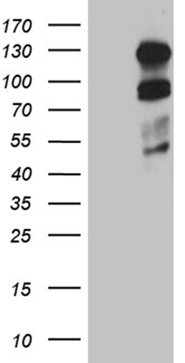 PLK4 Antibody in Western Blot (WB)