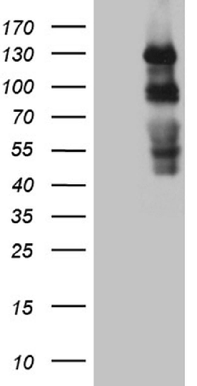PLK4 Antibody in Western Blot (WB)