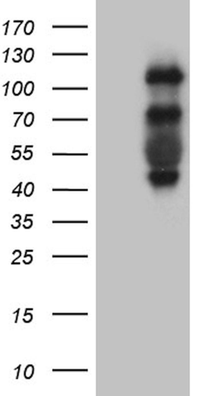 PLK4 Antibody in Western Blot (WB)