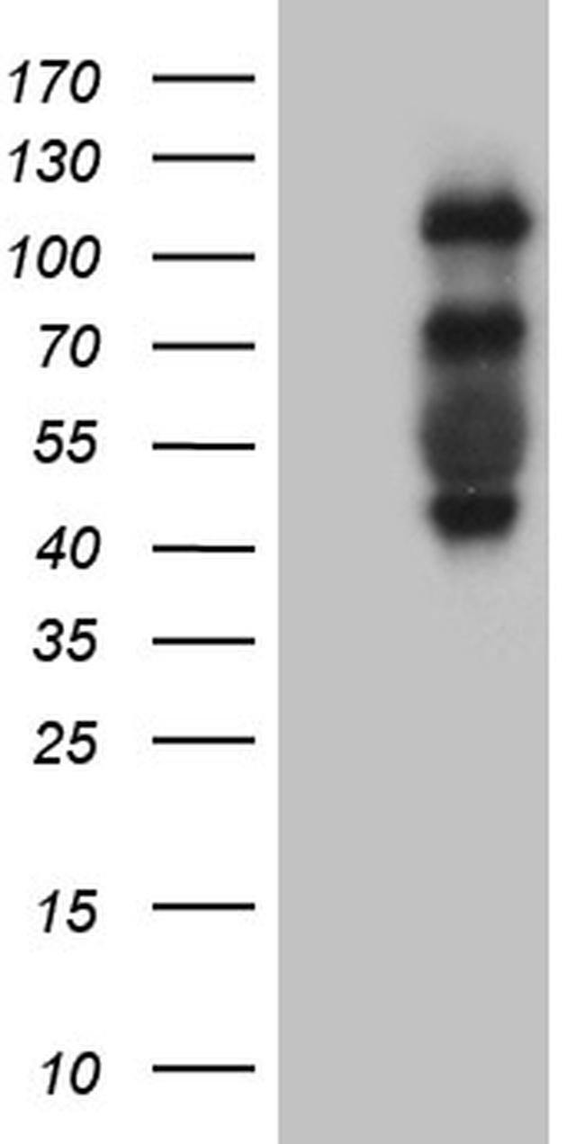 PLK4 Antibody in Western Blot (WB)