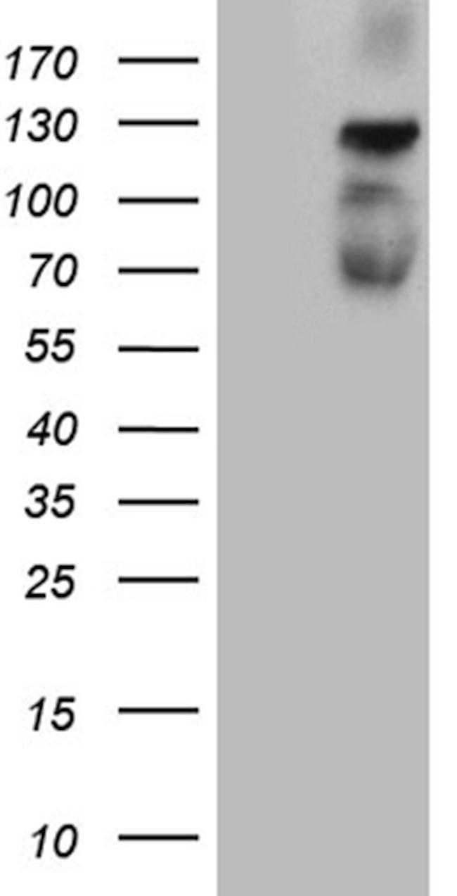PLK4 Antibody in Western Blot (WB)