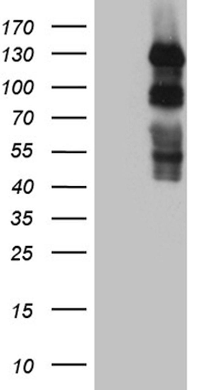 PLK4 Antibody in Western Blot (WB)