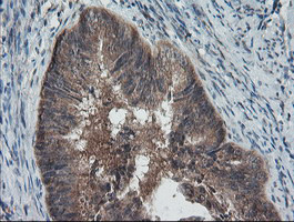 PMEL Antibody in Immunohistochemistry (Paraffin) (IHC (P))